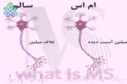 علائم ابتلا به بیماری ام اس جوانان چیست 