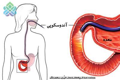 مراقبت و آمادگیها در آندوسکوپی 