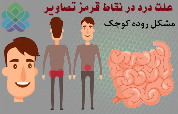 مشکلات روده کوچک