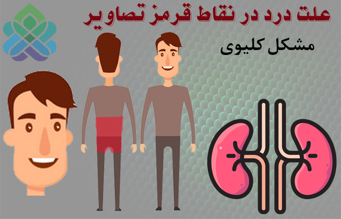 مشکلات کلیوی